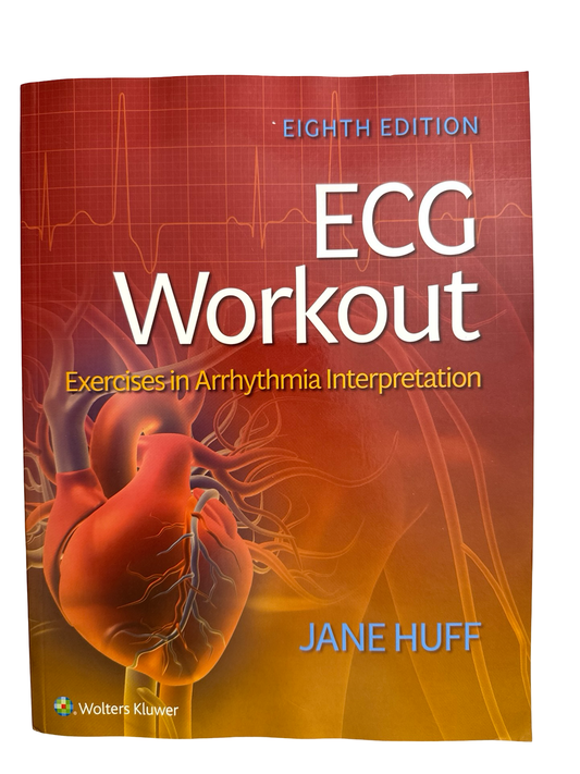 ECG workout exercises in Arrhythmia interpretation